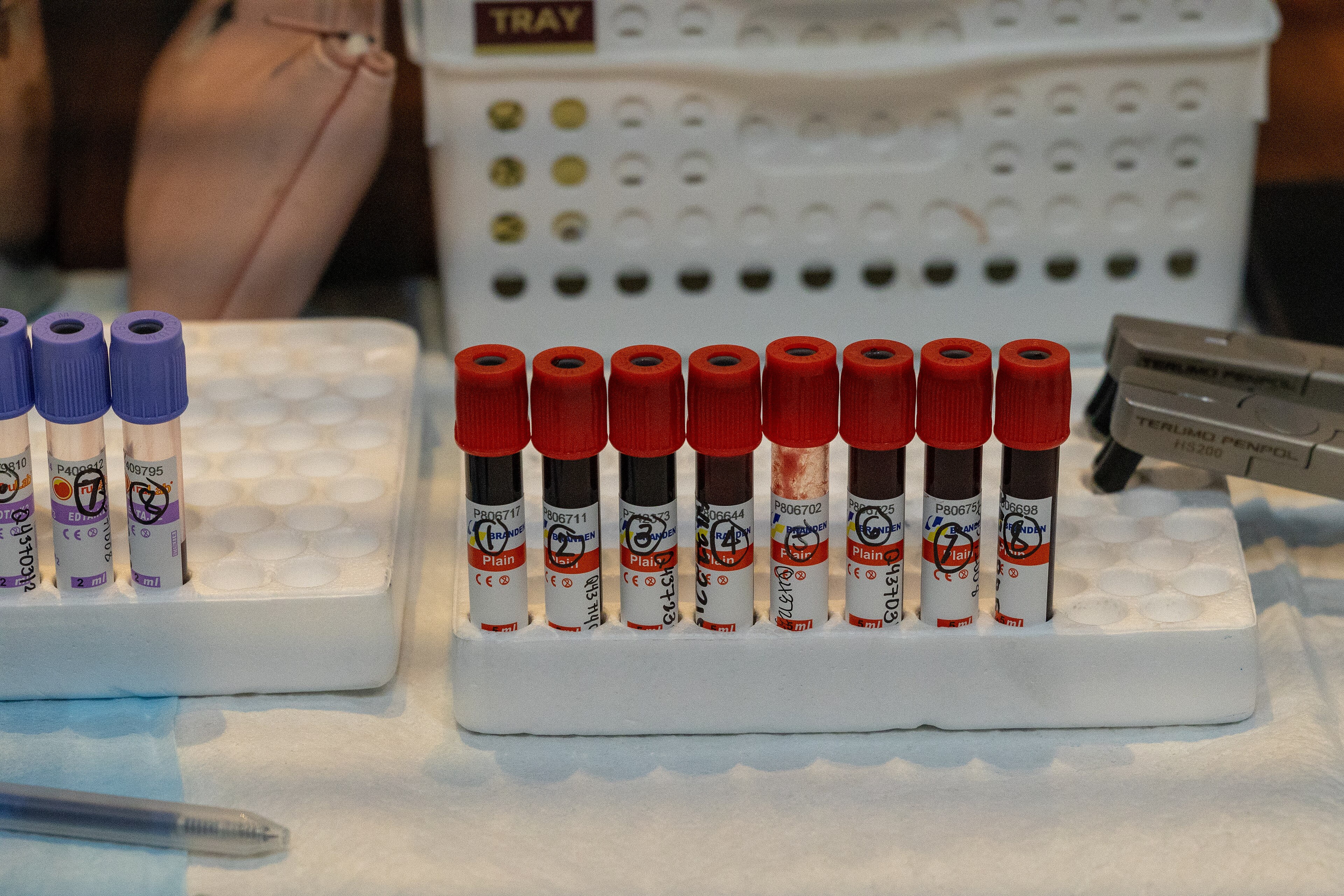 AI-powered precision blood testing may reduce the need for multiple blood tests